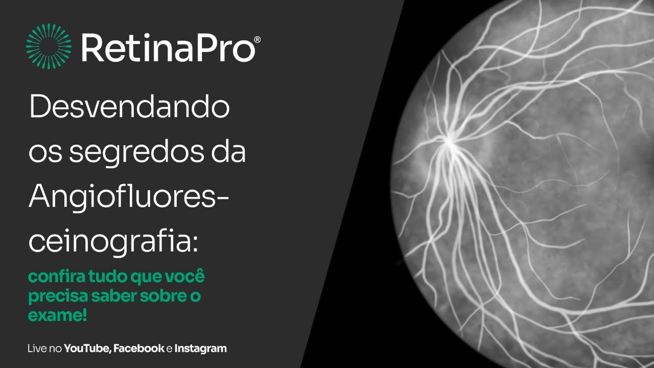 Angiofluoresceinografia: o que vc precisa saber a respeito do exame?