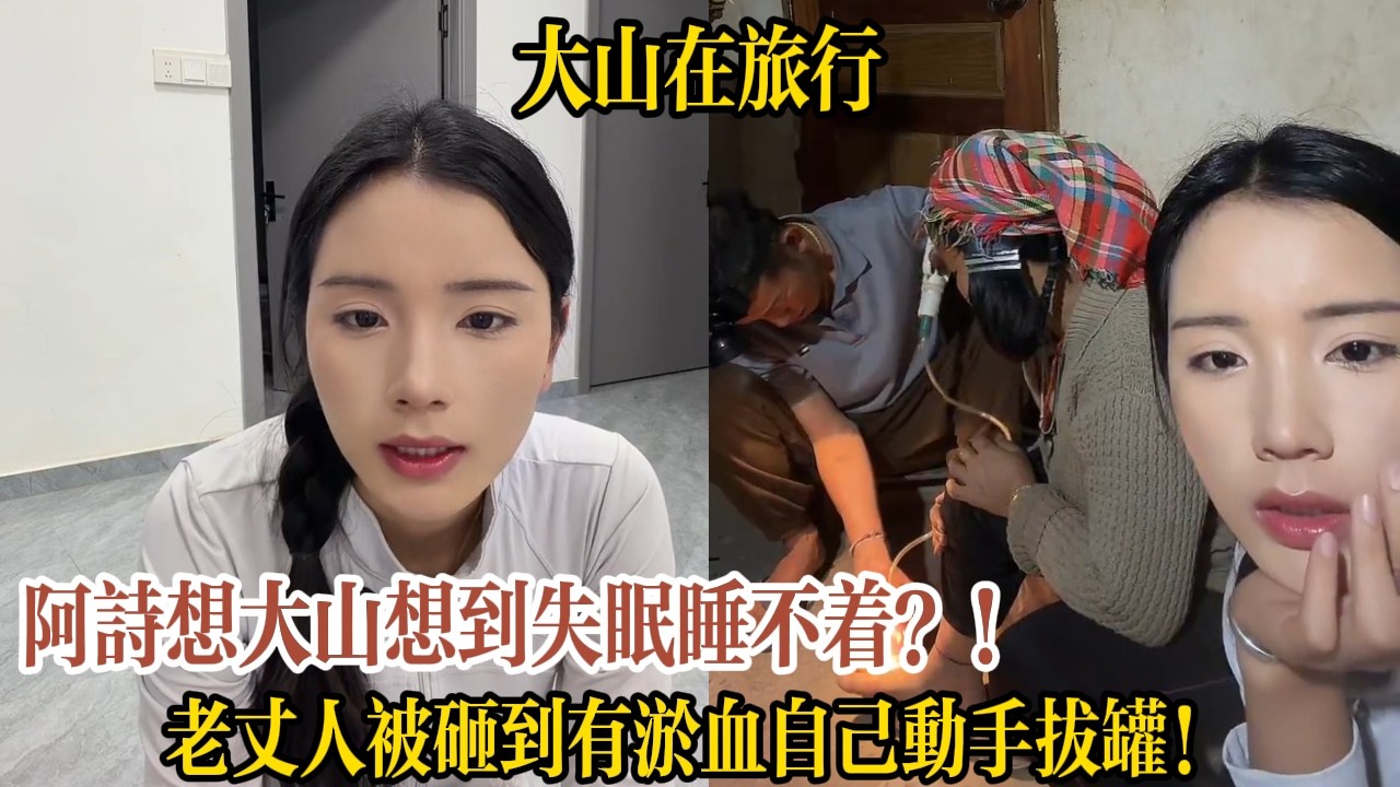 阿詩想大山想到失眠睡不著？！老丈人被砸到有淤血自己動手拔罐！【大山在旅行】