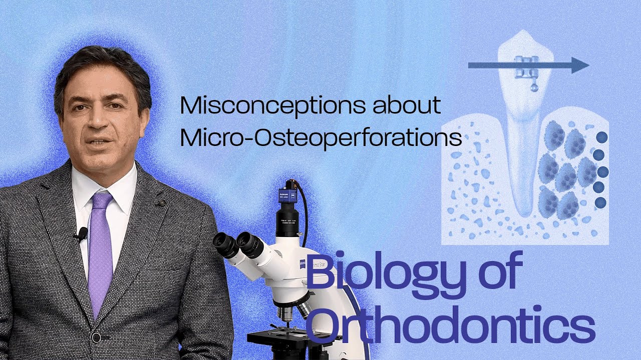Misconceptions about Micro-Osteoperforations - Biology Of Orthodontics 