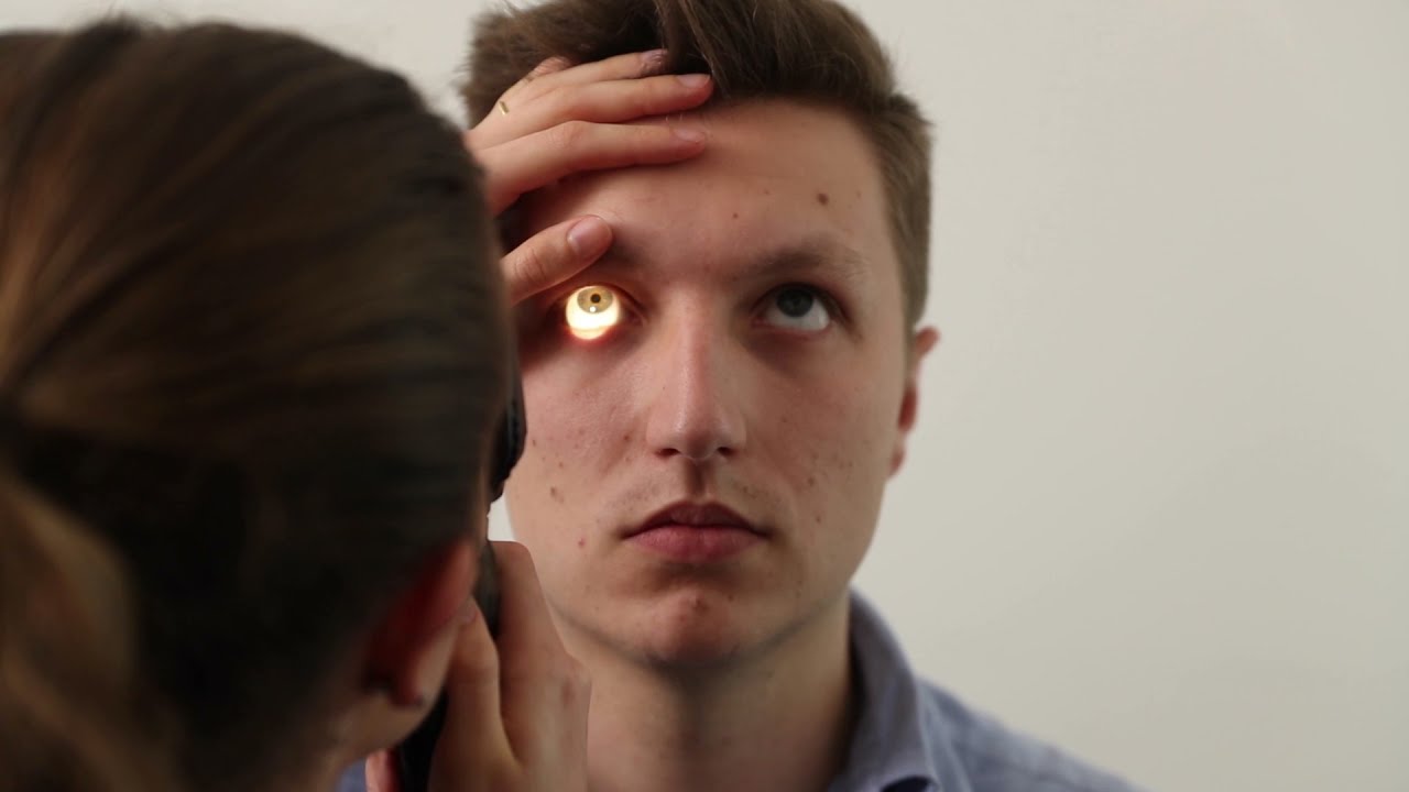 Fundoscopy