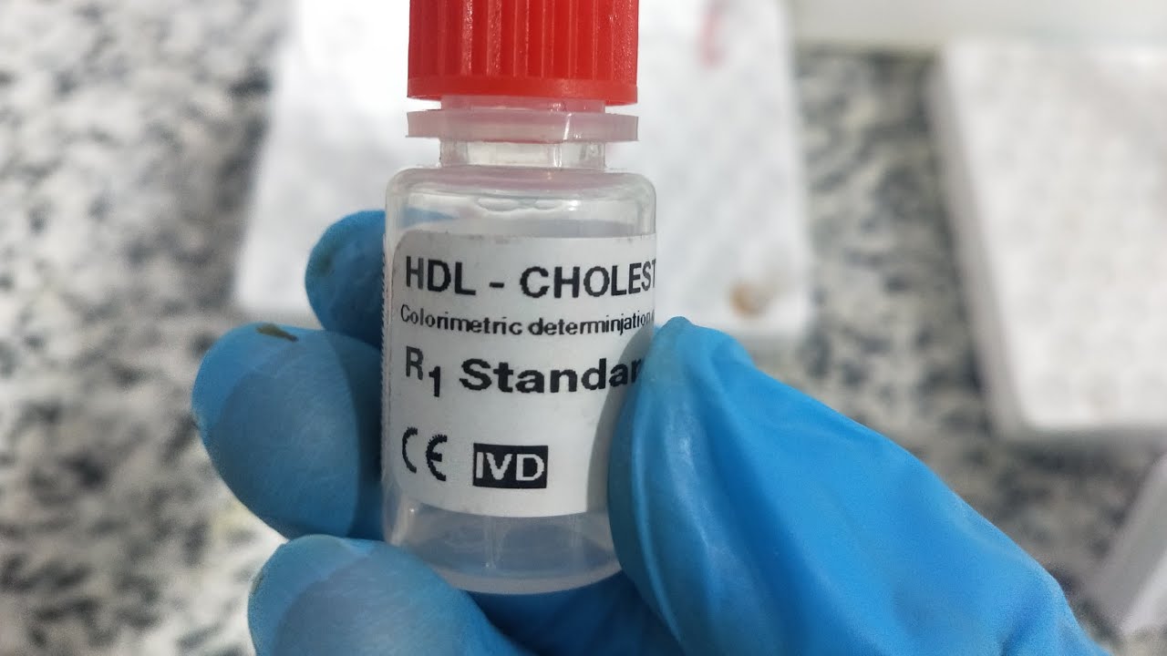 كيفية عمل تحليل HDL | Lipid Profile High density lipoprotein.