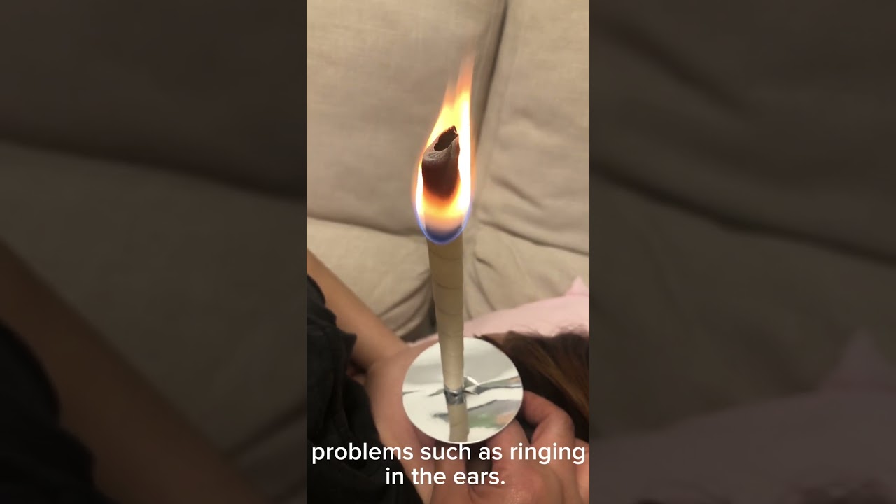 Ear Wax Remover, Ear Candling - worth it?