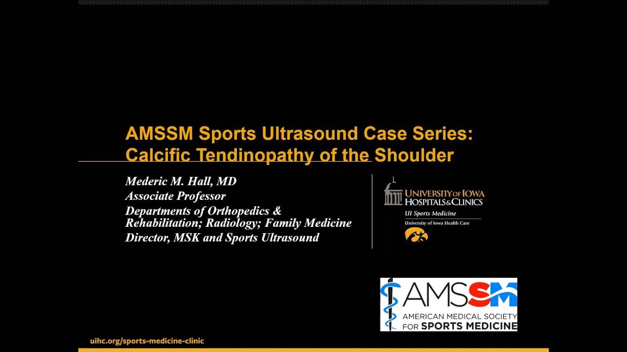 Shoulder with Dr. Mederic Hall | AMSSM Sports Ultrasound Case Presentation