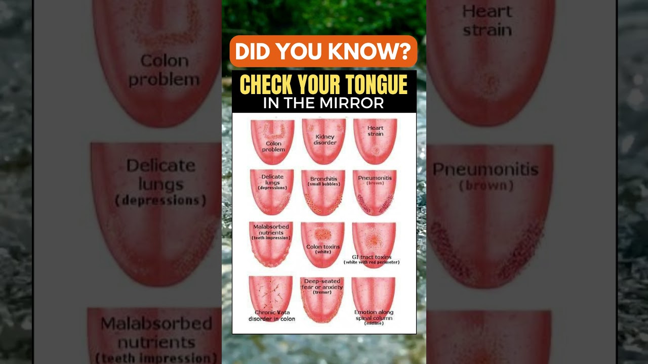 Tongue Diagnosis