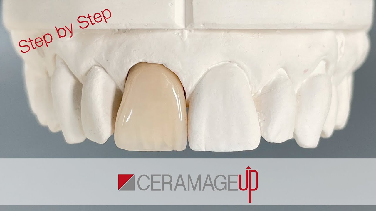Ceramage UP - Step by Step - Version 01
