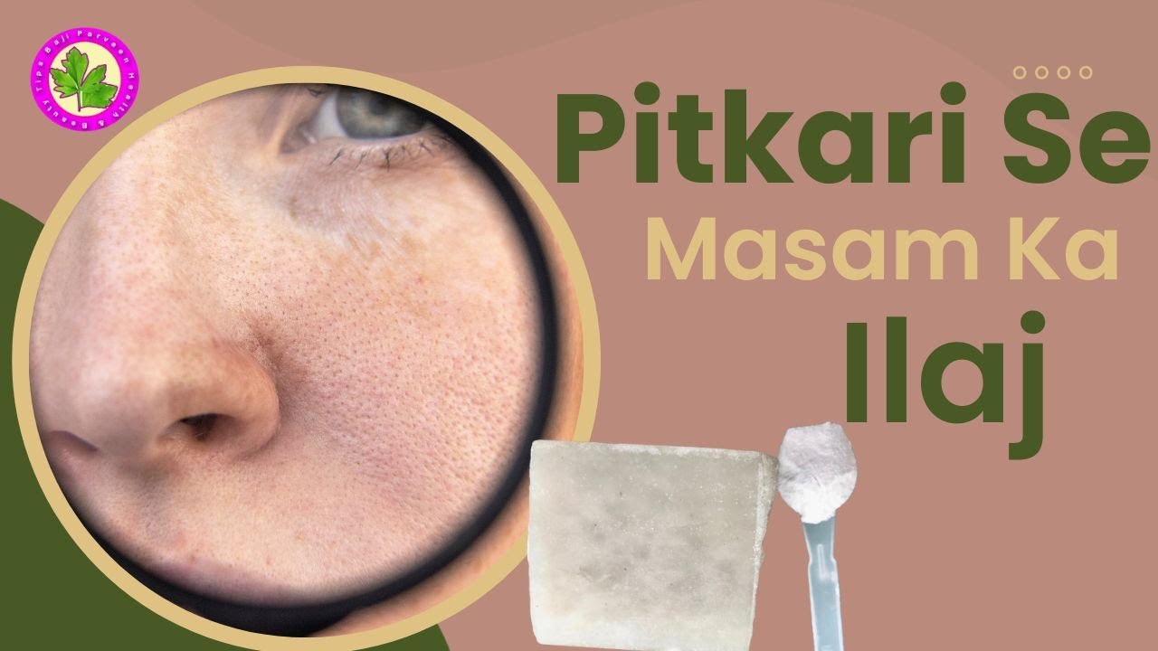 Open Pores Treatment - Phitkari Se Masam Ka Ilaj