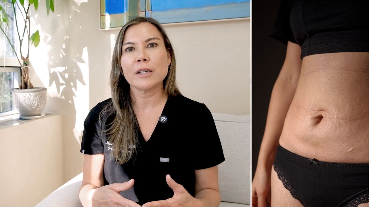 Thinking About a Mommy Makeover? Plastic Surgery for Moms: Timing, Safety & How to Plan It