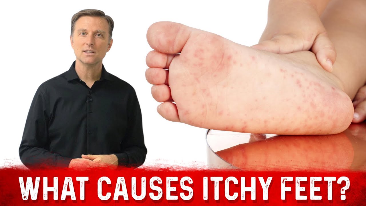 What Causes Itchy Feet and How to Stop It? &ndash; Dr. Berg