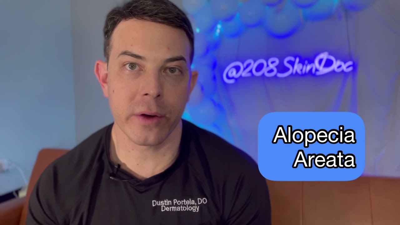 Losing Hair? What is Alopecia Areata? | 208SkinDoc