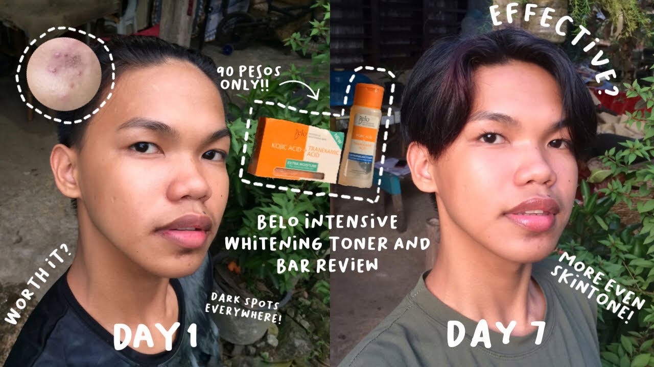 BELO INTENSIVE WHITENING TONER AND BAR REVIEW| MORE EVEN SKINTONE?!