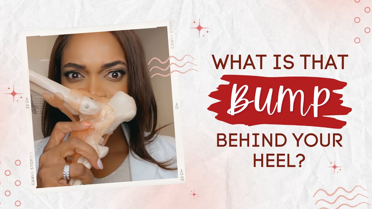 Haglund's Deformity: A Bony Bump Behind Your Heel #haglundsdeformity #foothealth #footdoctor