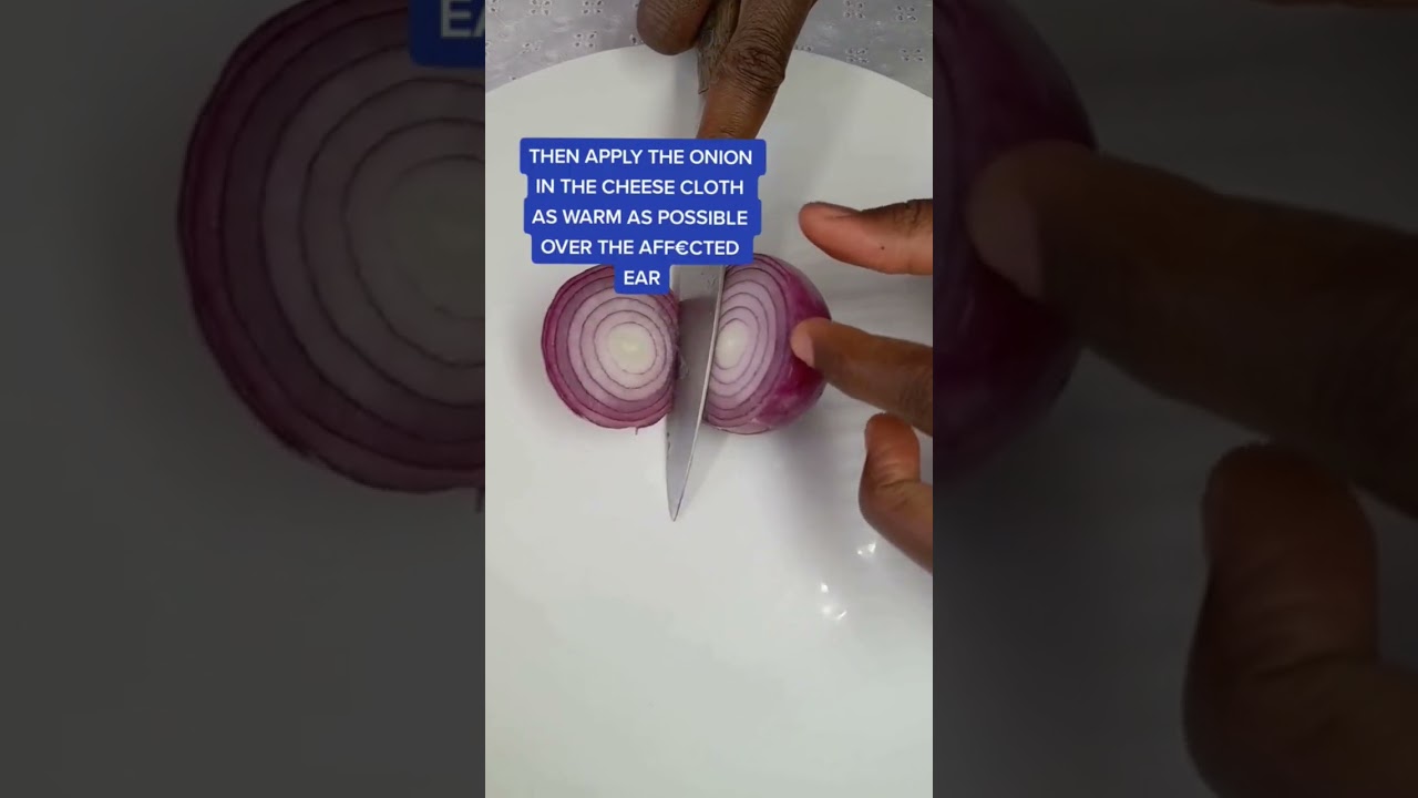 This onion remedy saved my earache in minutes....#homeremedies#earpain#onionforhealing#shorts