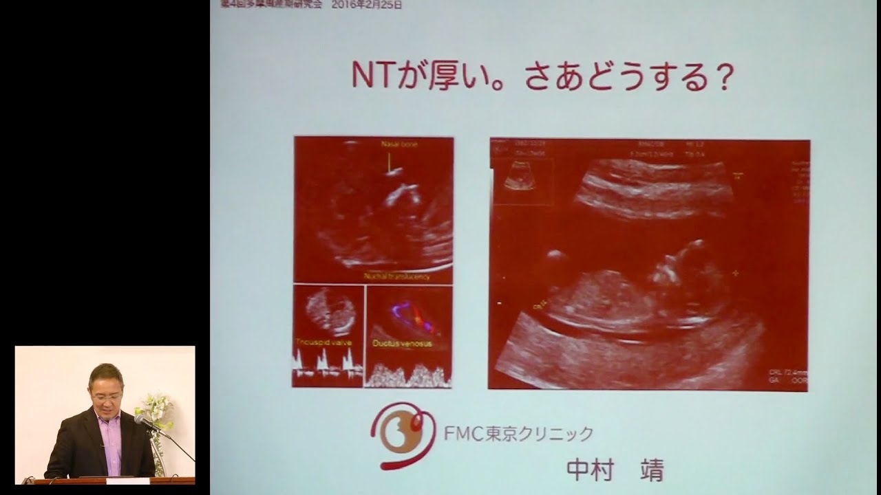 第4回多摩周産期研究会　特別講演「NTが厚い。さあどうする？」