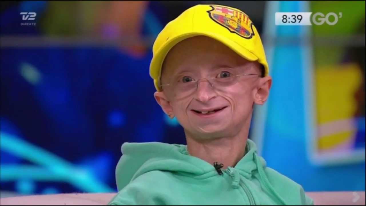 27/12: TV2 Go' Morgen Danmark med Jesper Sørensen - Progeria - Lalandia omtale