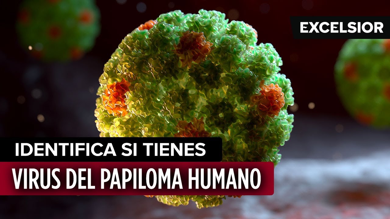 Identifica si tienes Virus del Papiloma Humano