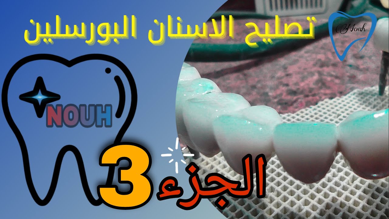الجزء الاخير من لو الاسنان البورسلين اتكسرت هتتصلح أزاى(يوجد كلام مهم جدا )Porcelain Teeth Repair