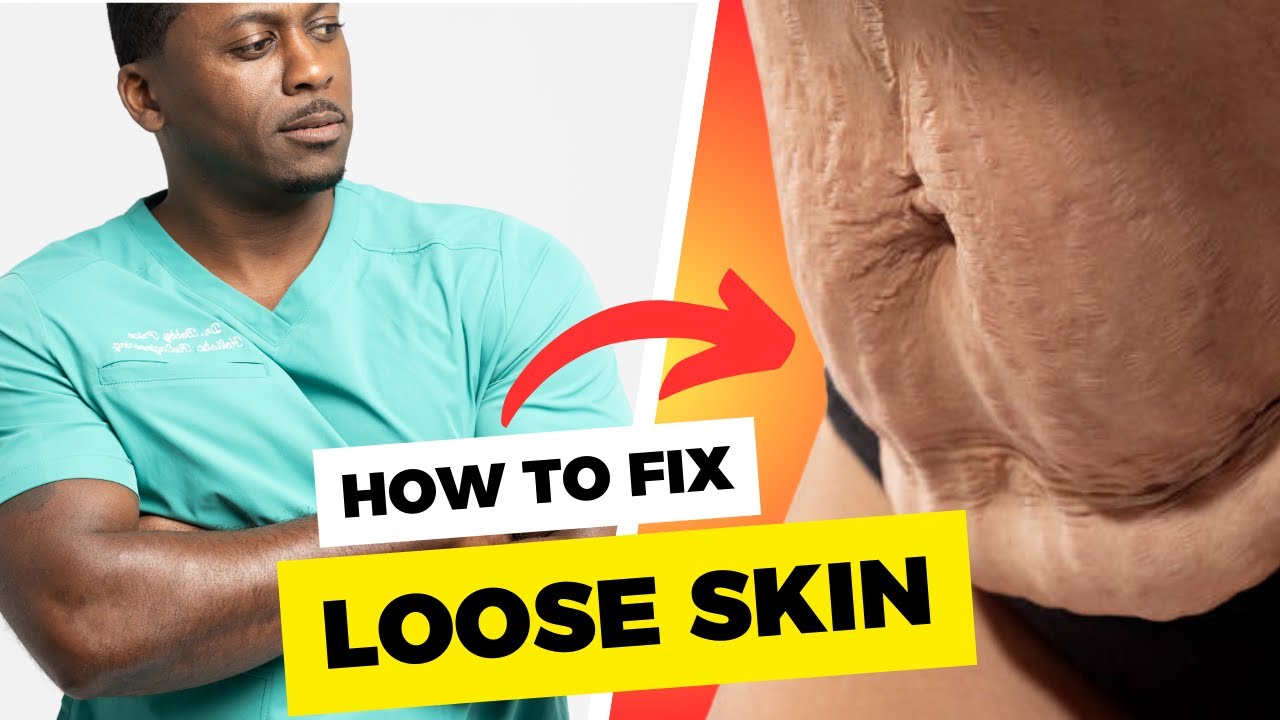How To Fix LOOSE SKIN After Major Weight Loss