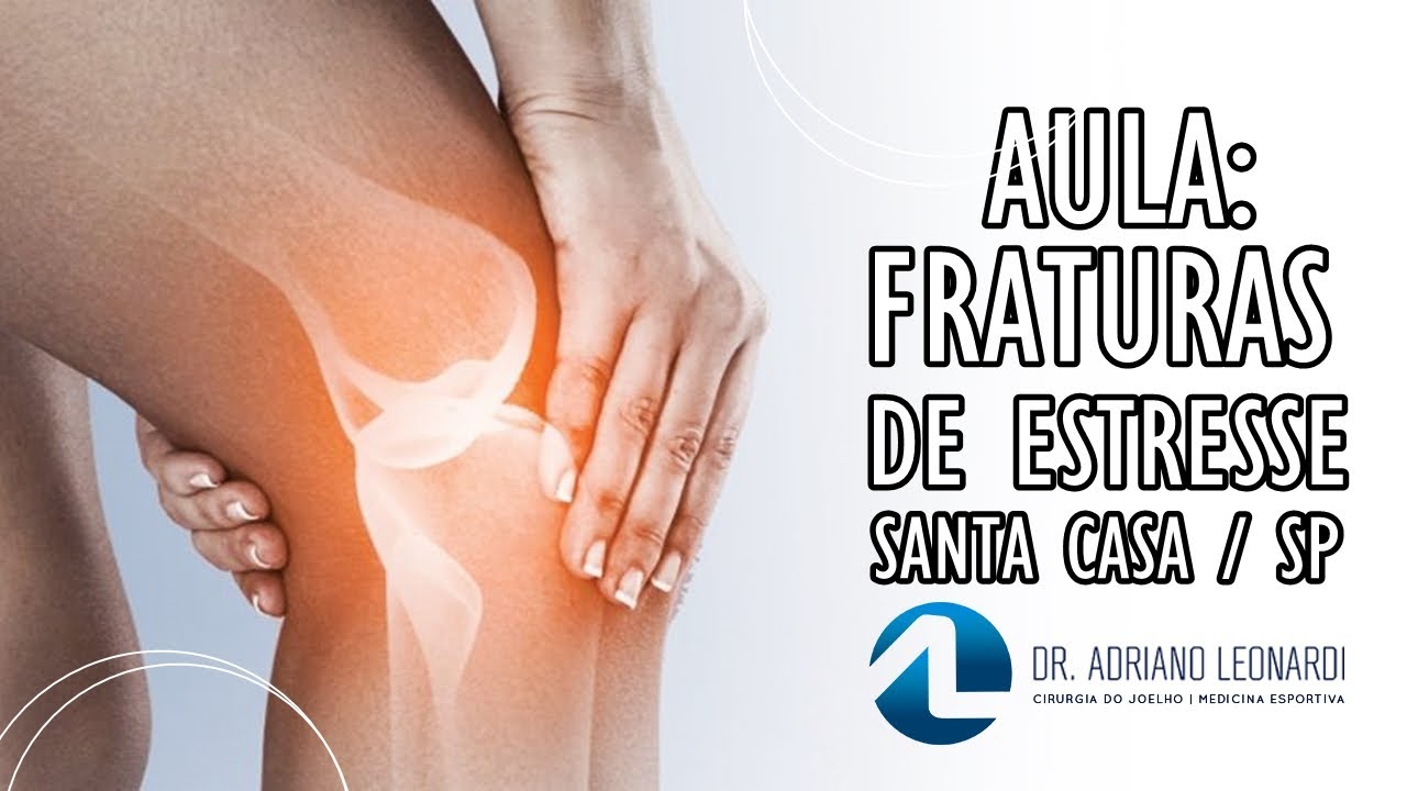 AULA DE FRATURA DE ESTRESSE - Santa Casa de S&atilde;o Paulo - Dr Adriano Leonardi