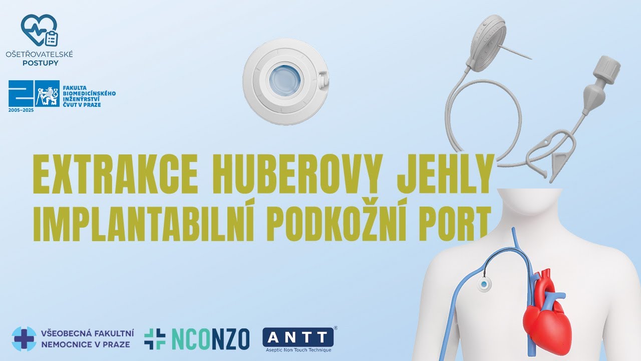 PLNĚ IMLANTABILNÍ VENÓZNÍ PORT 2/2 - EXTRAKCE HUBEROVY JEHLY 🩹 | OŠETŘOVATELSKÉ POSTUPY