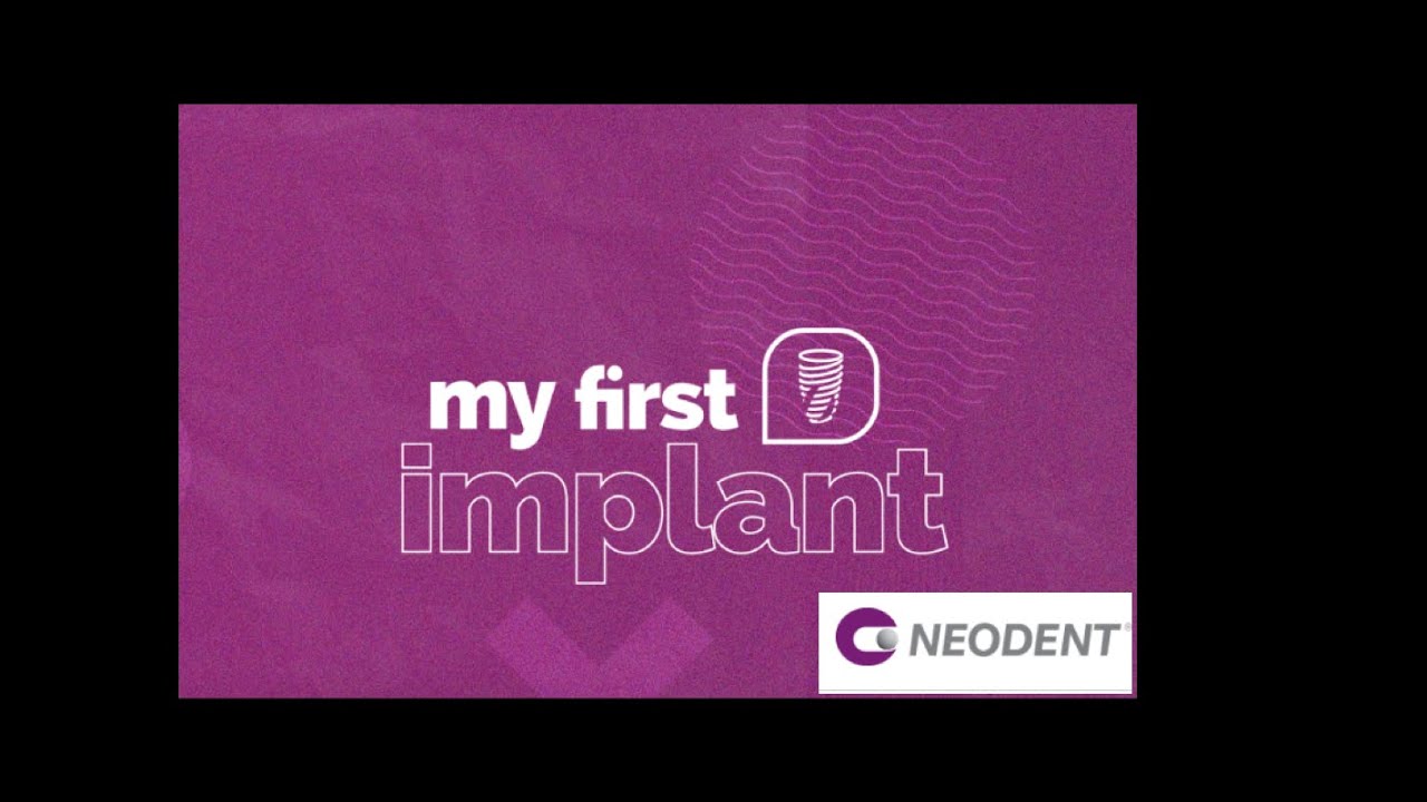 Componentes protéticos em Implantodontia - My first implante - Neodent