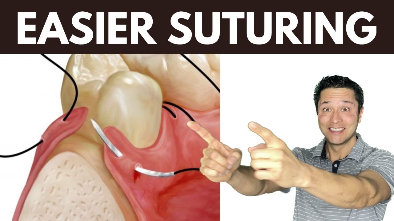 Suturing Made Simple! - PERIODONTIST HELP!