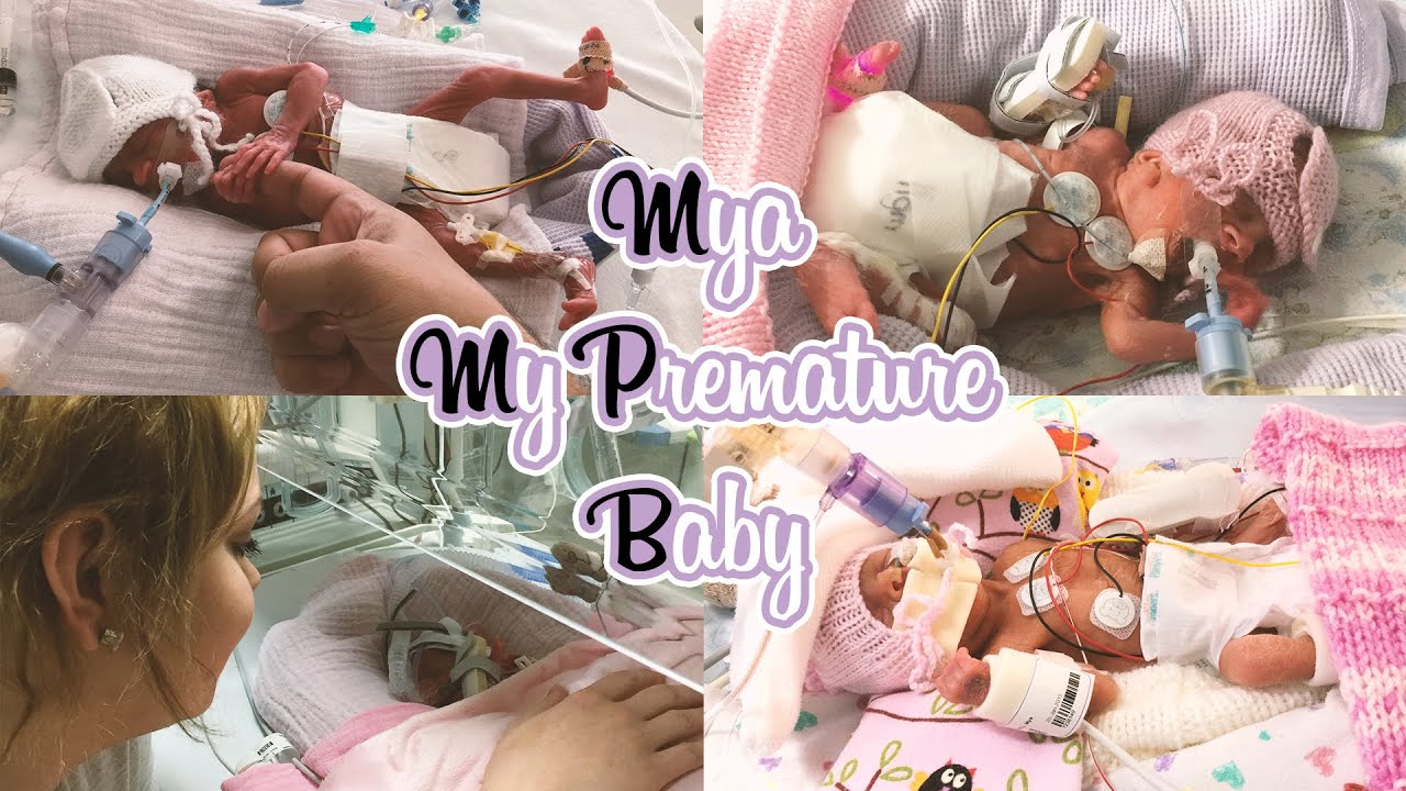 Mya, My 24 Week Premature Baby | Family Vlog 60