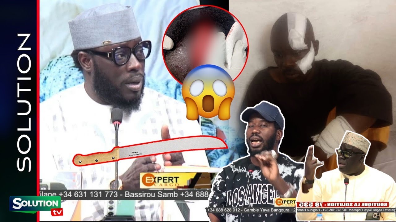 UN MAITRE CORANIQUE AGRESSÉ PAR UN BERGER BAYE ASSANE RACONTE L'HORREUR...SA NDIOGOU KOU DIEUL DIASI