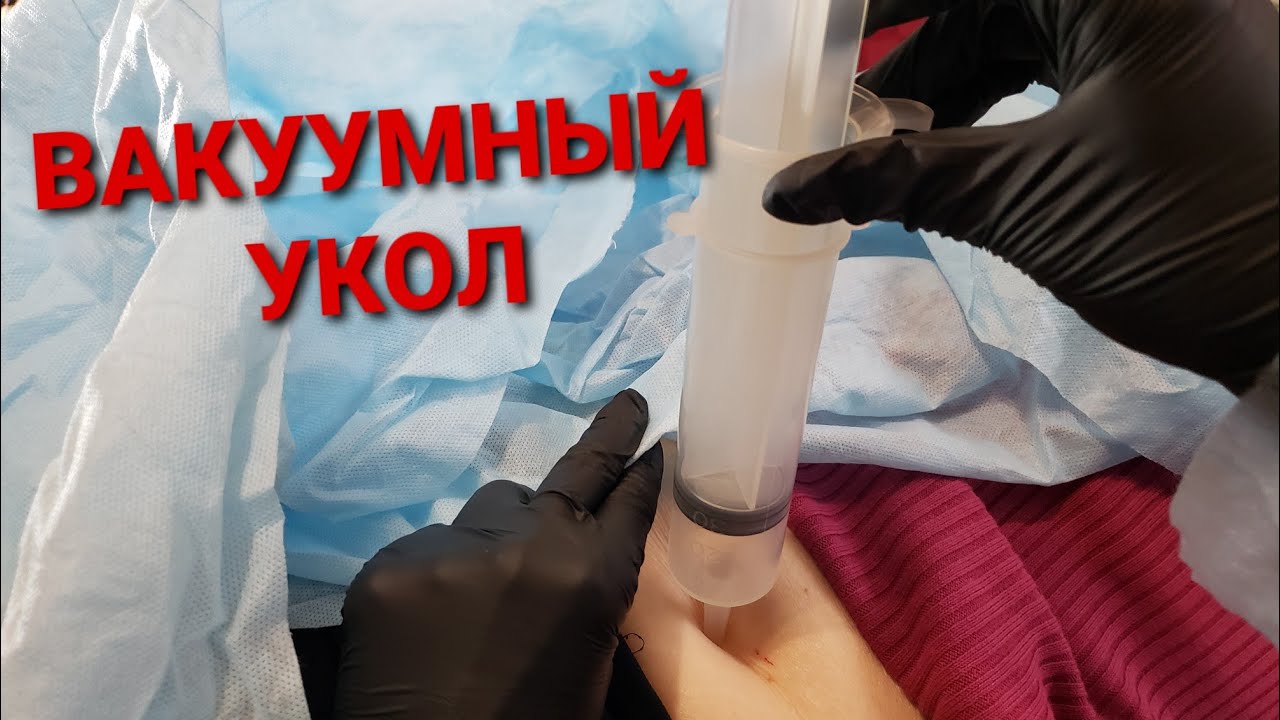 Большой Вакуумный УКОЛ Доктор на работе.Crazy Doctor