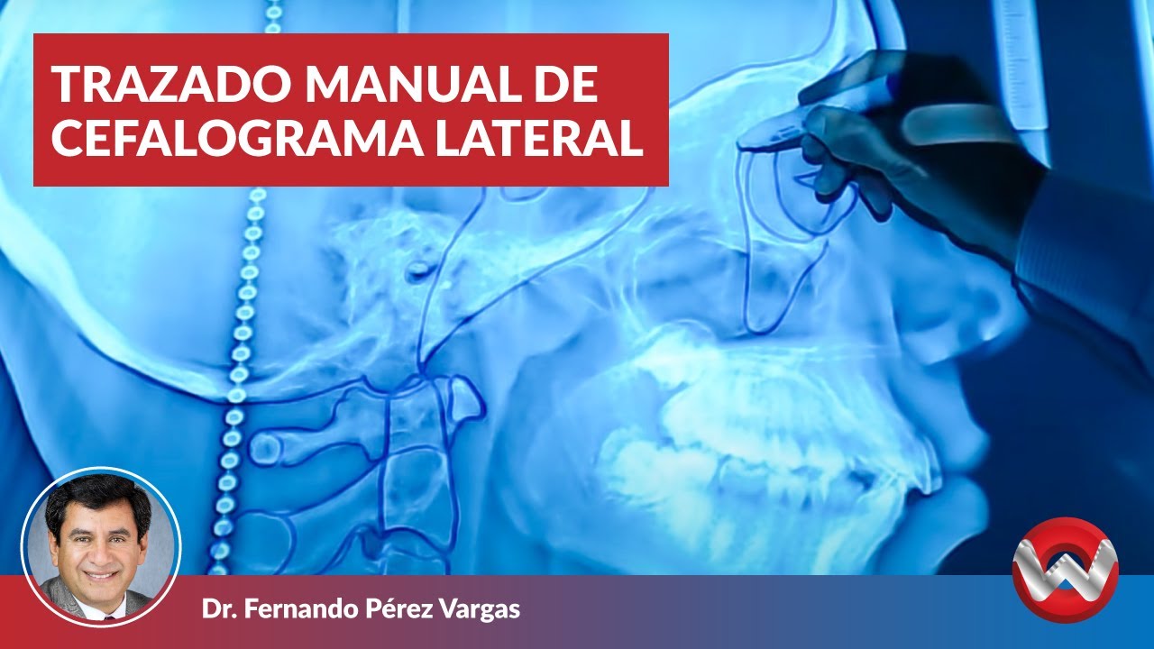 Trazado manual de cefalograma lateral