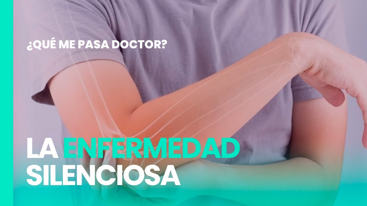 QUÉ ME PASA DOCTOR: Osteoporosis, la enfermedad silenciosa que afecta a 200 millones de personas
