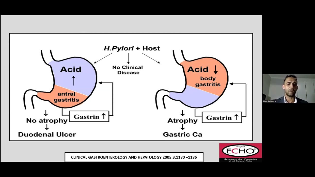 Pre-malignant conditions of the stomach
