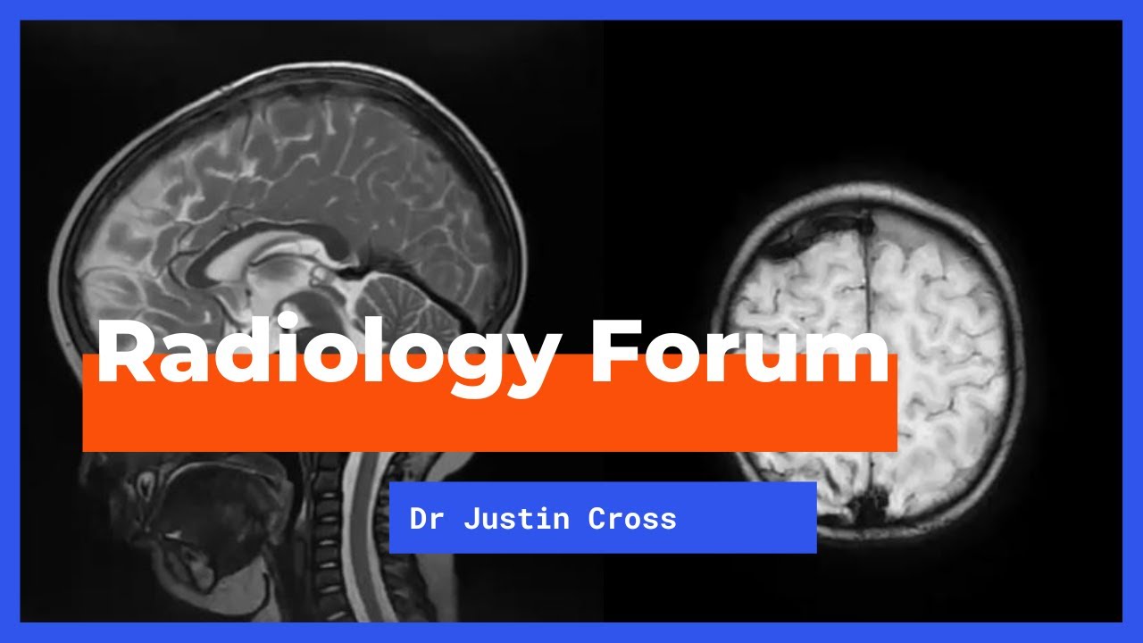'Paediatric Neuroradiology on Call Cases' by Dr Justin Cross
