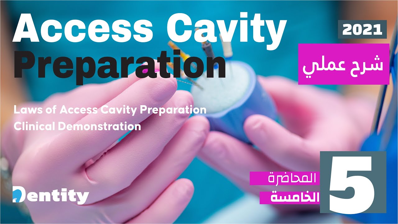 المحاضرة الخامسة في علاج العصب | Access Cavity Preparation