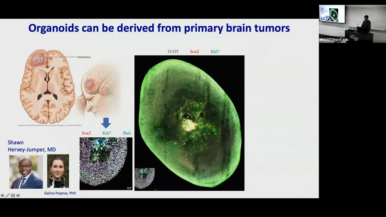 Establishing Pre-Clinical Models for Human Neurological Disorders | Tom Nowakowski, PhD