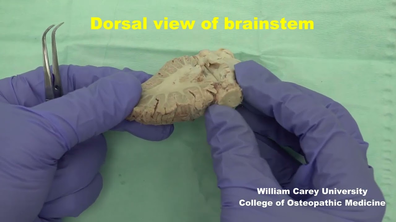 Dorsal and ventral views of the human brainstem; brief study. #neuroanatomy #brainstem#brain