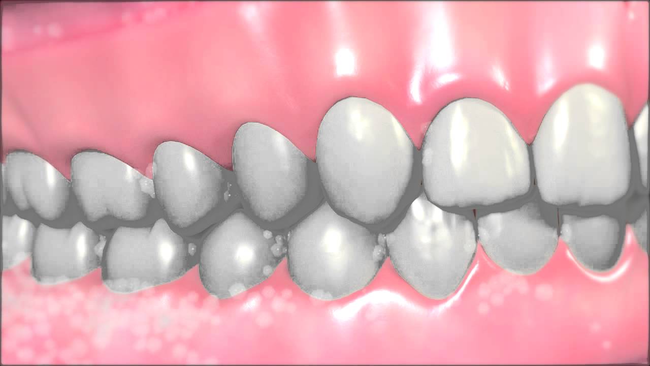 Вот как нужно ухаживать за зубными протезами, как настоящий профессионал!