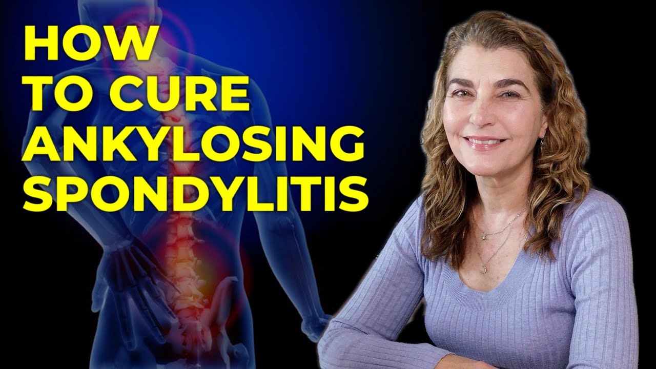 How To Cure Ankylosing Spondylitis - Back Pain