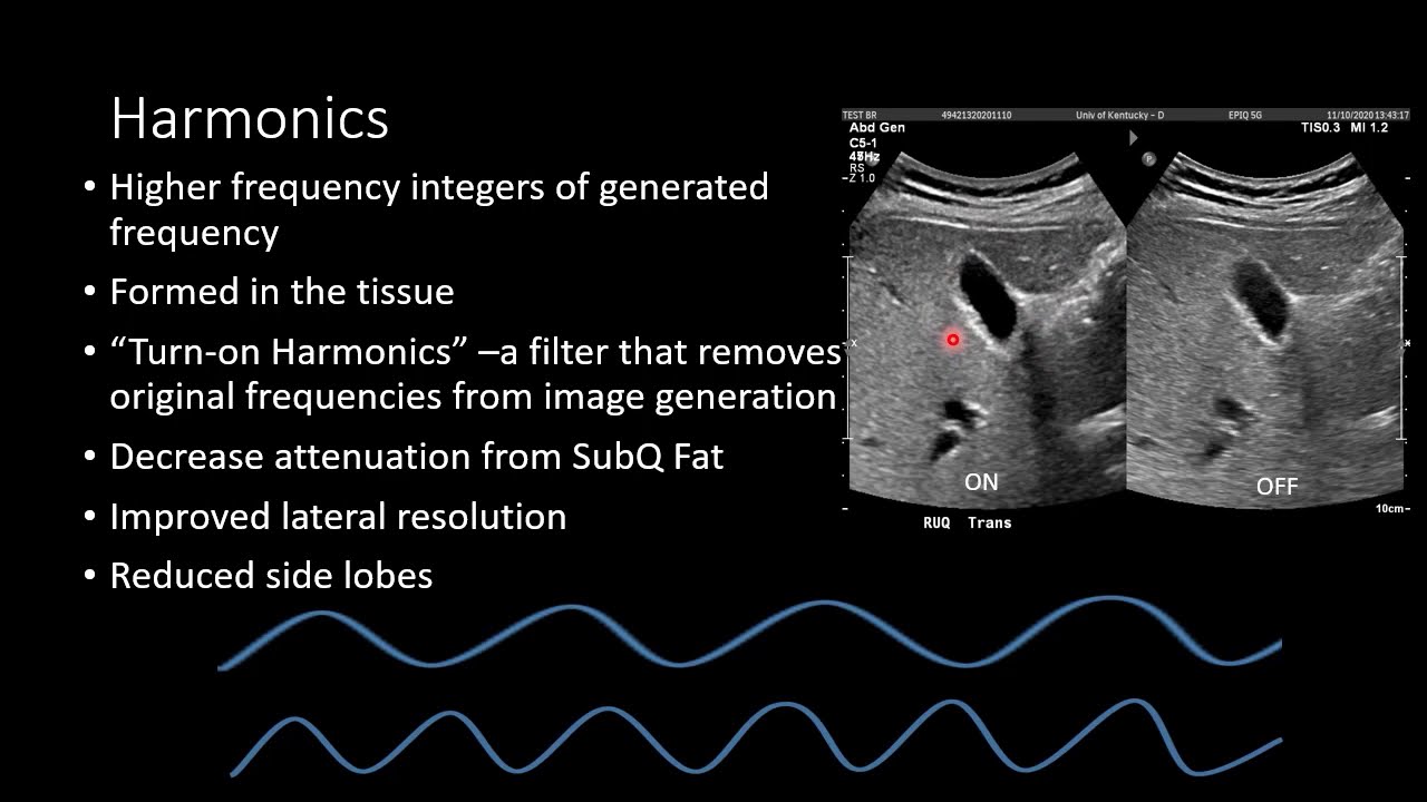 Ultrasound Physics - Image Generation