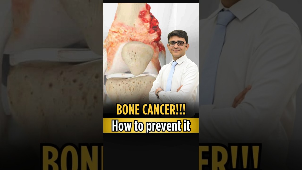 𝐇𝐨𝐰 𝐓𝐨 𝐏𝐫𝐞𝐯𝐞𝐧𝐭 𝐁𝐨𝐧𝐞 𝐂𝐚𝐧𝐜𝐞𝐫 ? 𝐇𝐞𝐫𝐞'𝐬 𝐓𝐡𝐞 𝐓𝐫𝐮𝐭𝐡. | 𝐃𝐫. 𝐑𝐚𝐣𝐚𝐭 𝐆𝐮𝐩𝐭𝐚.