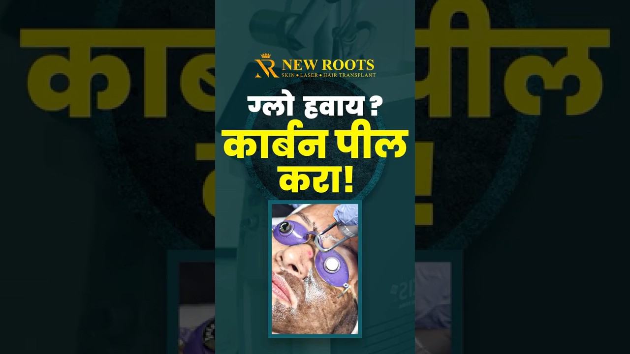 Уменьшите количество прыщей и черных точек с помощью лазерной карбоновой пилинг-процедуры 👀 