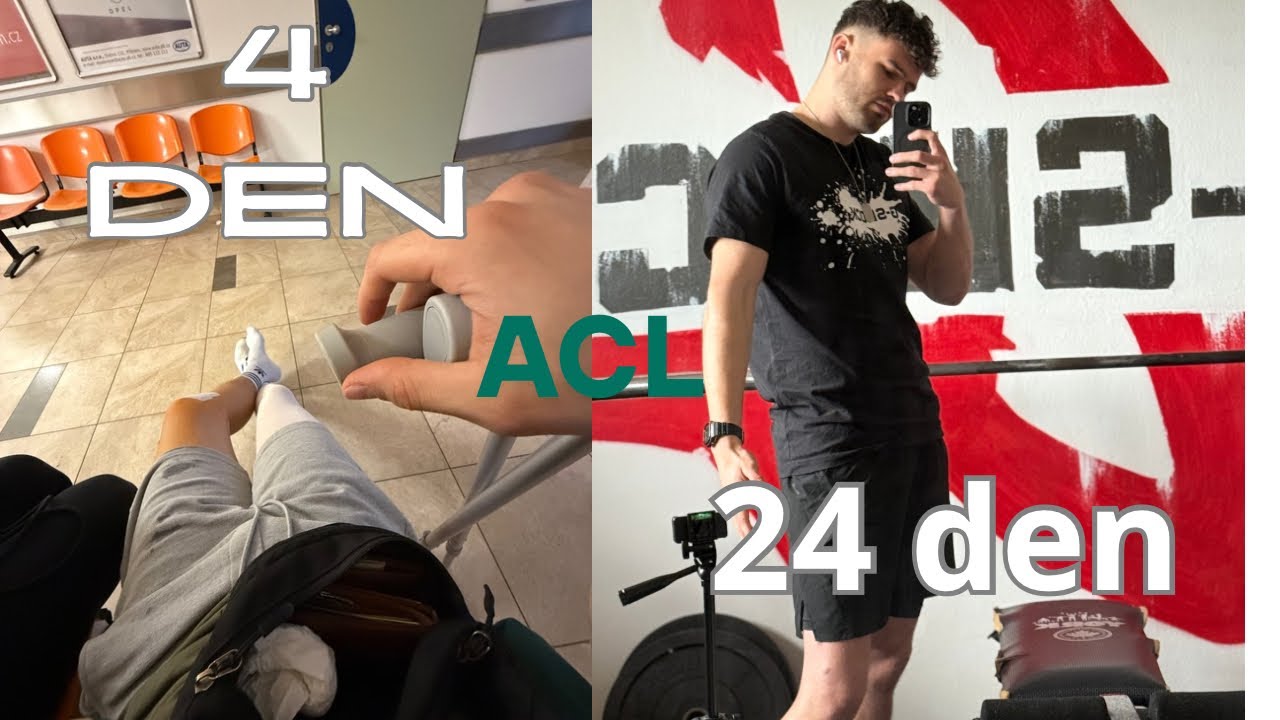 24 DNÍ PO OPRACI ACL - Komplikace, průběh + cvičení