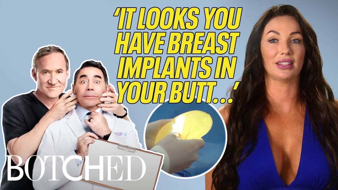 Doctors Tell Jana That Her Butt Is Made of BREAST IMPLANTS?! (Before & After) | Botched | E!