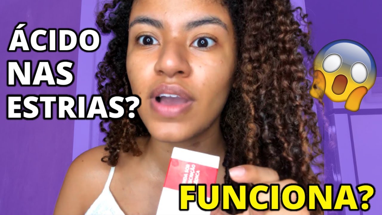 Tratamento para estrias brancas com Vitacid XT | DI&Aacute;RIO DE ESTRIAS | Vict&oacute;ria Brito