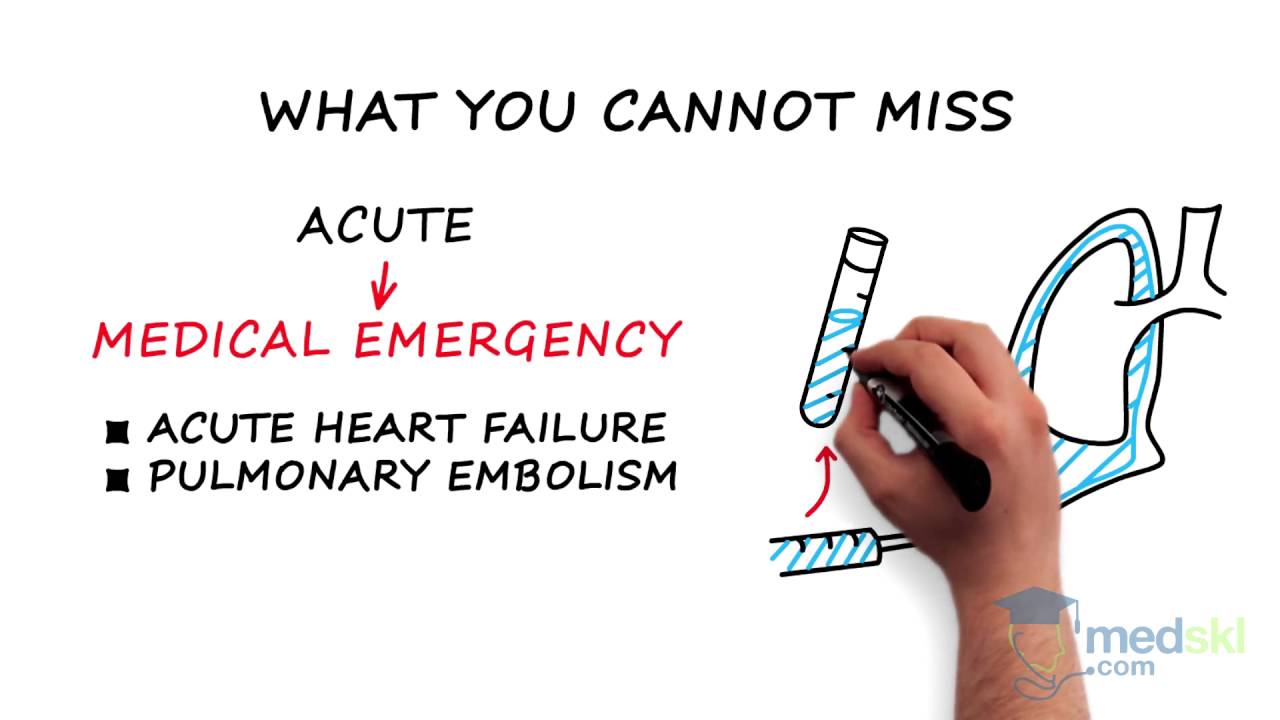 Respirology &ndash; Pleural Effusion: By Marcio Gomes M.D.