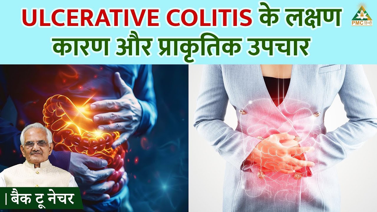 Ulcerative Colitis Symptoms, Causes & Natural Remedies in Hindi | Dr. NK Sharma | Back to Nature
