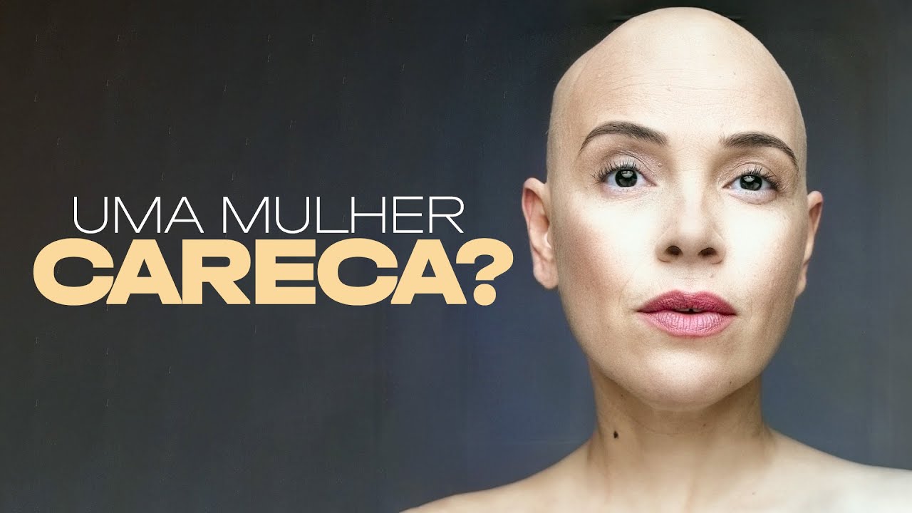 Como &eacute; ser uma mulher careca | Alopecia Areata