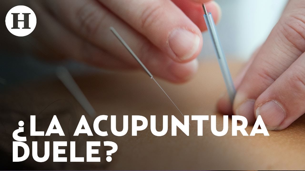 Acupuntura, mitos y realidades: ¿Medicina tradicional china que sana el cuerpo y el alma?