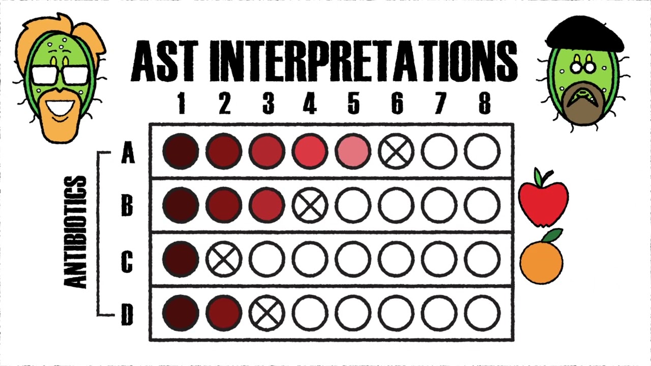 Essential Tips to Use and Interpret Antimicrobial Susceptibility Tests