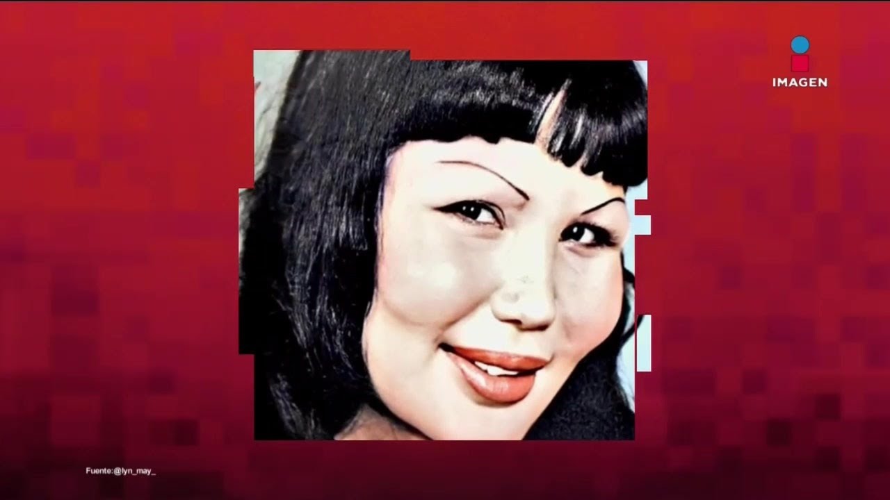 'Me quería M0RIR' Lyn May al ver cómo quedó su ROSTRO cuando le inyectaron ACEITE de cocina
