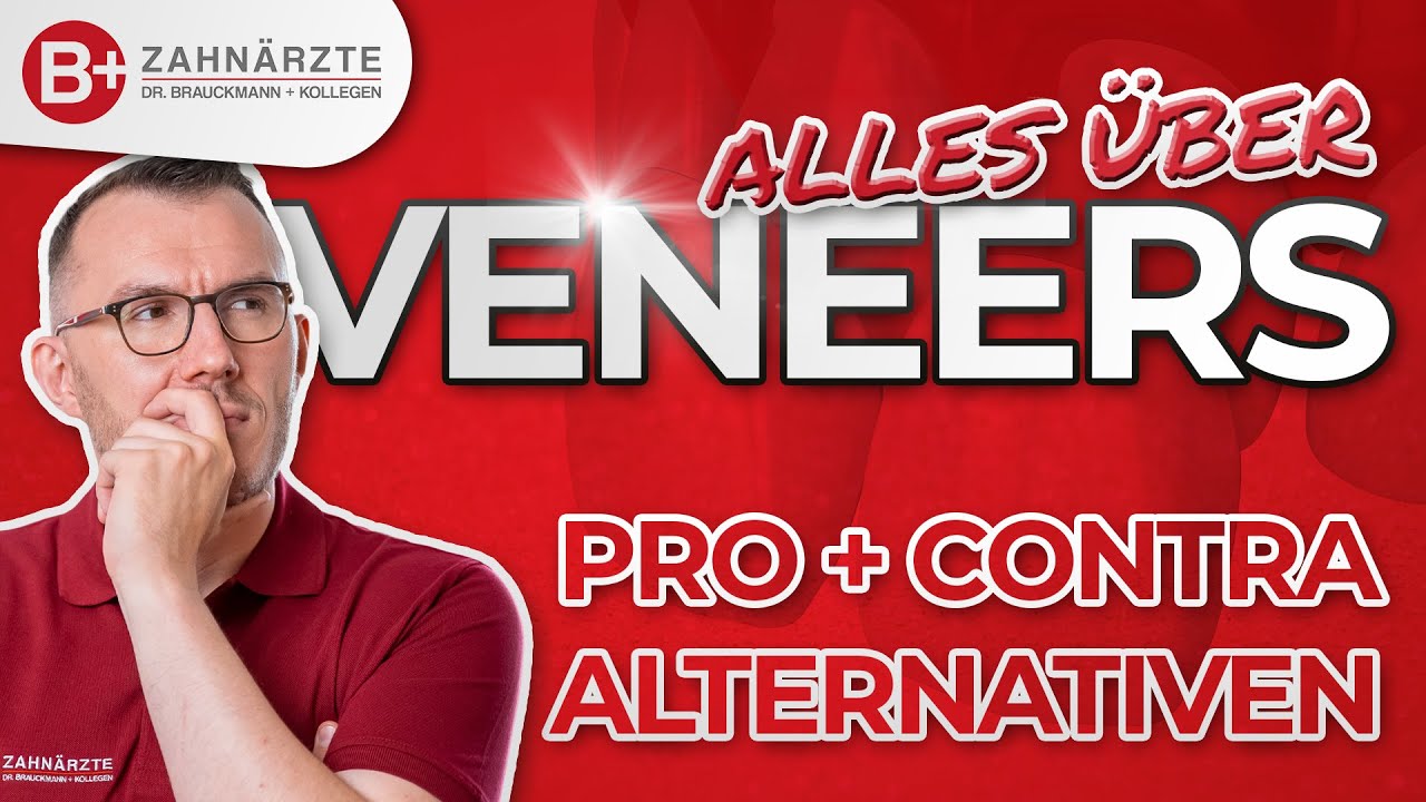 VENEERS / Verblendschalen für deine Zähne: Das sind die Vor- & Nachteile + Alternativen!